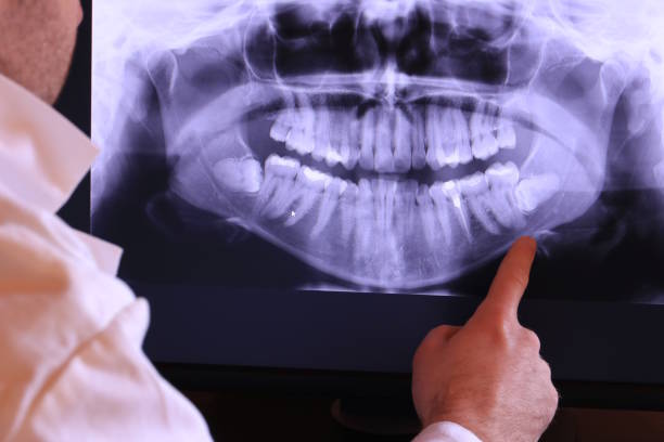 Best Emergency Treatment for Dental Infections or Abscesses in Granite City, IL