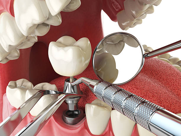 Best Cosmetic Emergency Dentistry in Granite City, IL