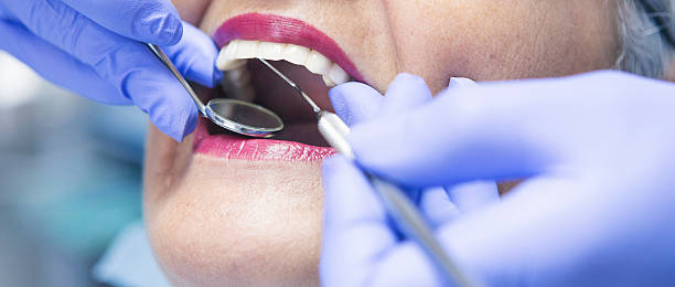 Best Emergency Dental Care for Broken or Chipped Teeth in Granite City, IL